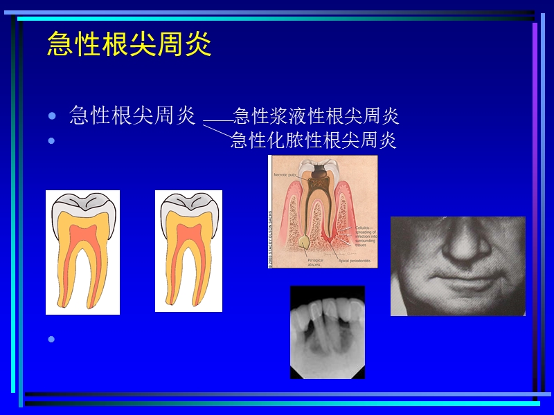 口腔常见病的诊断和药物治疗.ppt_第3页