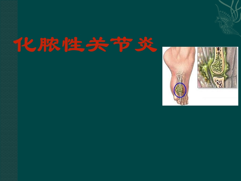 化脓性关节炎讲课用.ppt_第1页