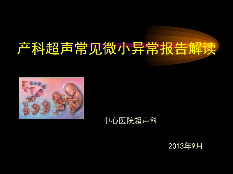 产科超声常见微小异常报告解读.ppt_第1页