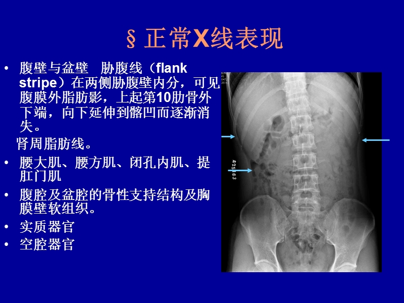 急腹症2015.ppt_第3页