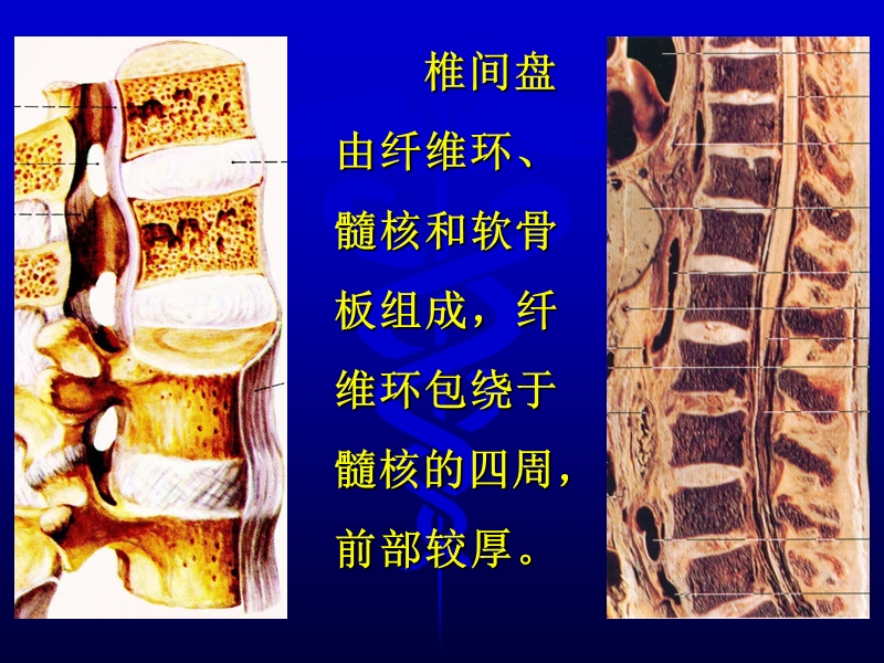 椎间盘病变影像诊断.ppt_第2页