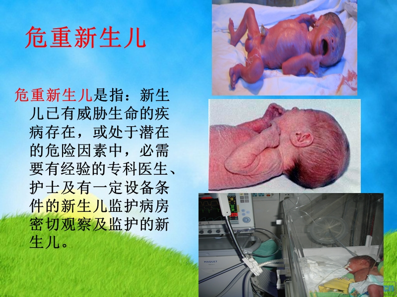 危重新生儿的早期识别xin.ppt_第3页