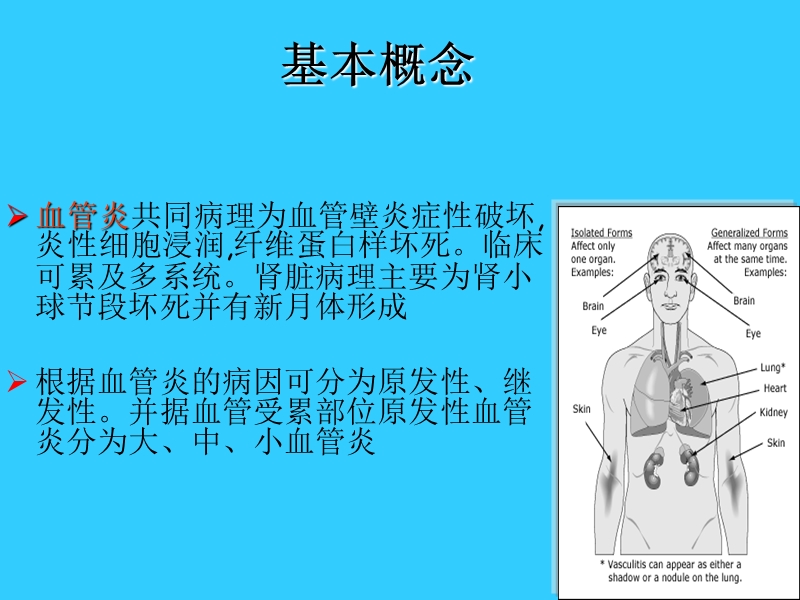 原发性血管炎.ppt_第2页