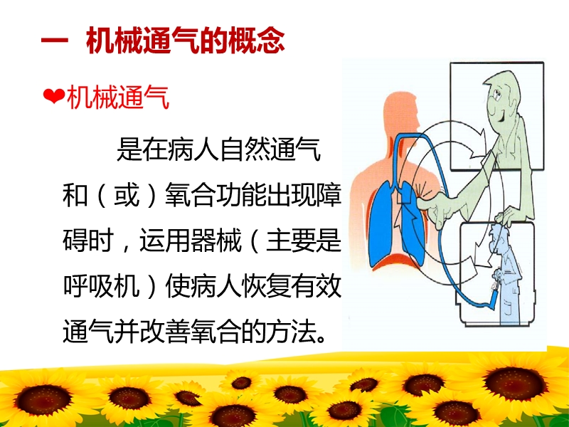 危重病人的气道管理.ppt_第3页