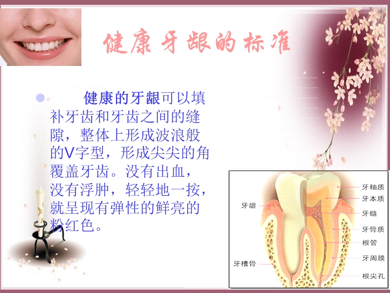 口腔健康.ppt_第2页