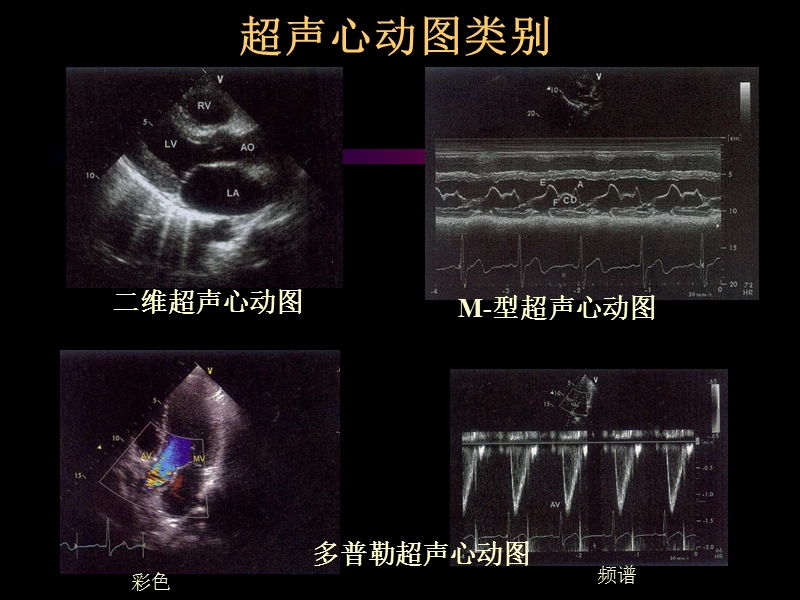 心脏超声心动图基础篇.ppt_第3页