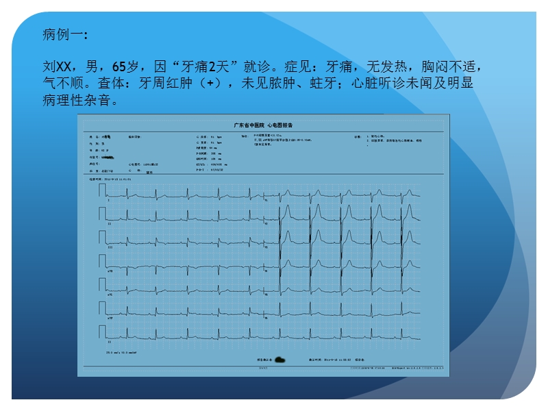 心电图诊断学(wqh)-1.pptx_第2页