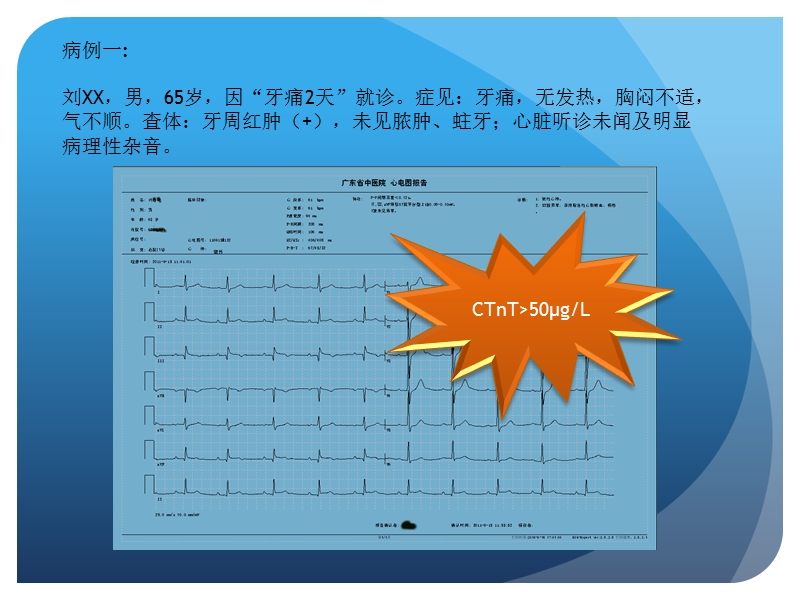 心电图诊断学(wqh)-1.pptx_第3页