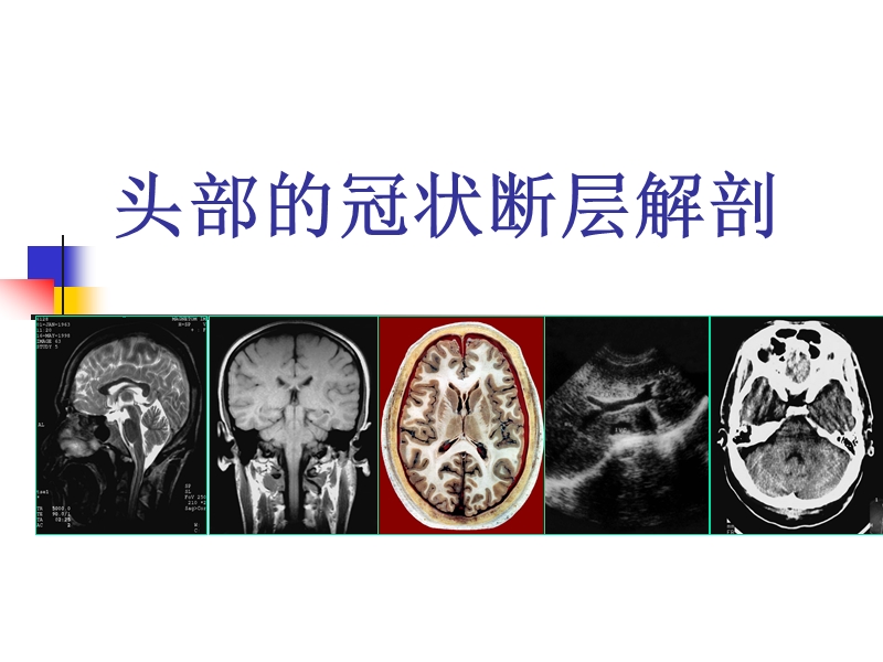 头部的冠状断层解剖应用.ppt_第1页