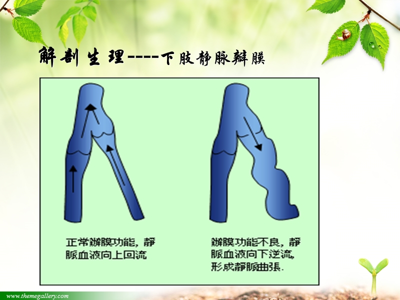 周围血管疾病的护理.ppt_第3页