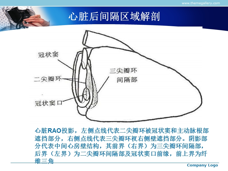 后间隔室上速的鉴别诊断.ppt_第3页