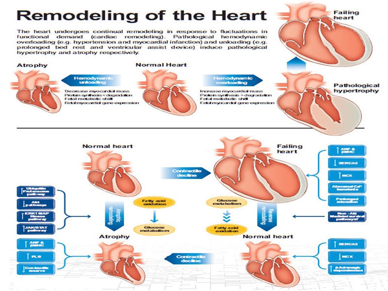心力衰竭与心室重构.ppt_第2页