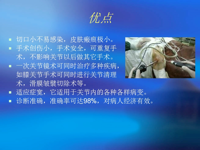 关节镜手术护理幻灯.ppt_第3页