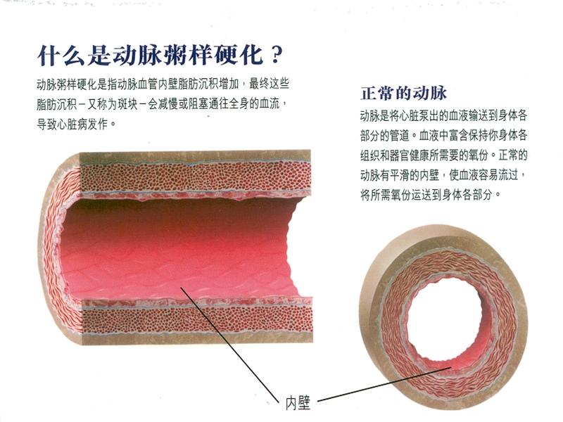 如何积极预防心脑血管疾病.ppt_第2页