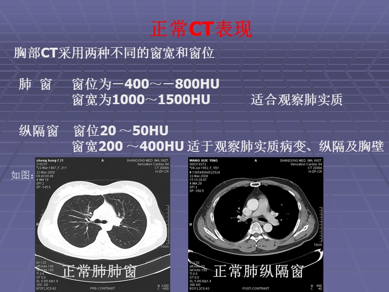 正常胸肺部ct影像学表现.ppt_第2页