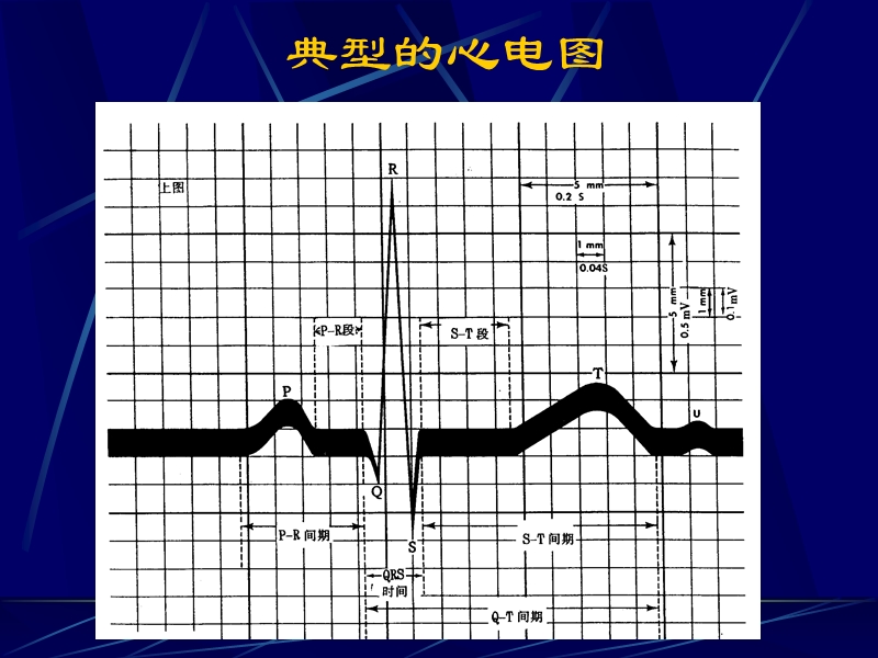 小儿心电图.ppt_第3页