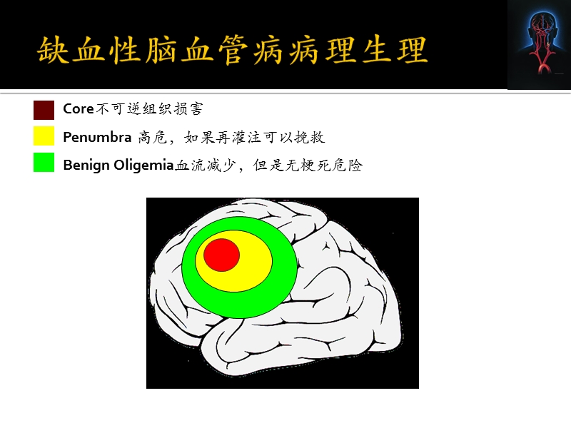 缺血性卒中病因及发病机制的分型.pptx_第3页