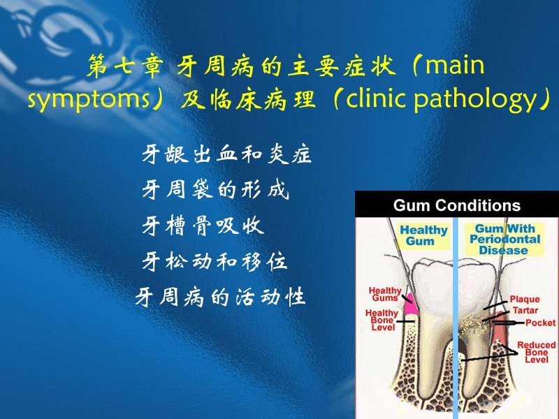 第七章_牙周病的主要症状.ppt_第1页