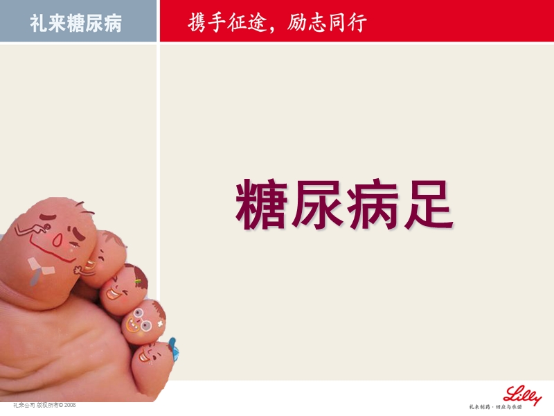 糖尿病足.ppt_第1页