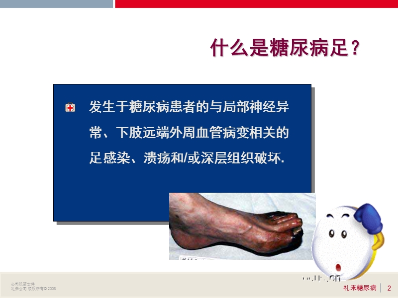 糖尿病足.ppt_第2页