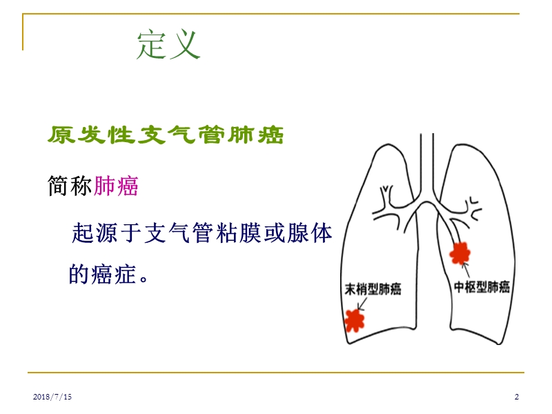 肺癌患者护理 PPT.pptx_第2页