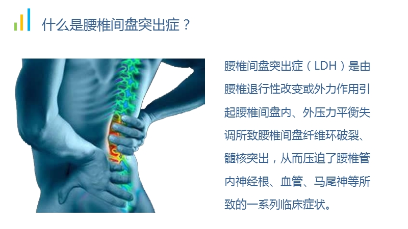 腰椎间盘突出.ppt_第3页