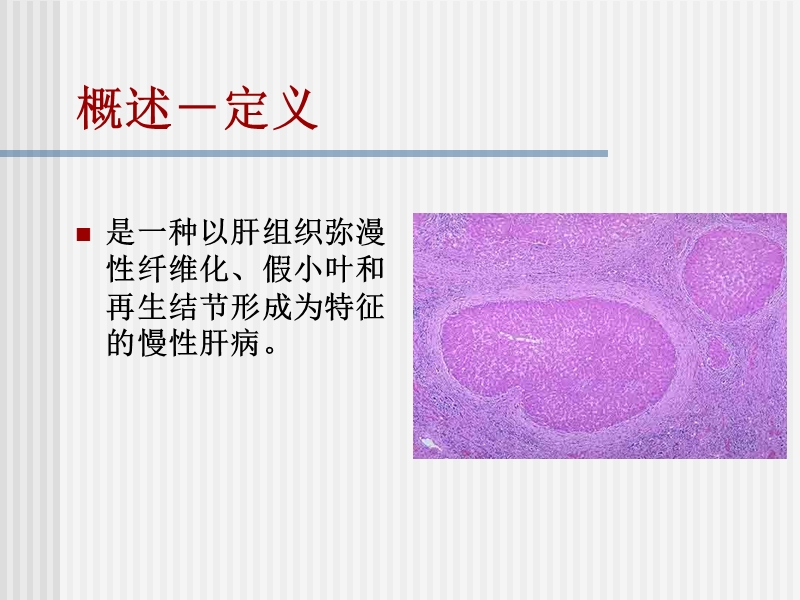 肝硬化-消化内科.ppt_第3页