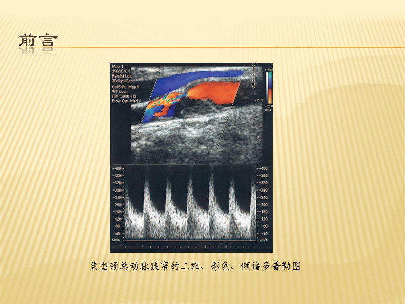 血管超声仪器调节基础.ppt_第2页