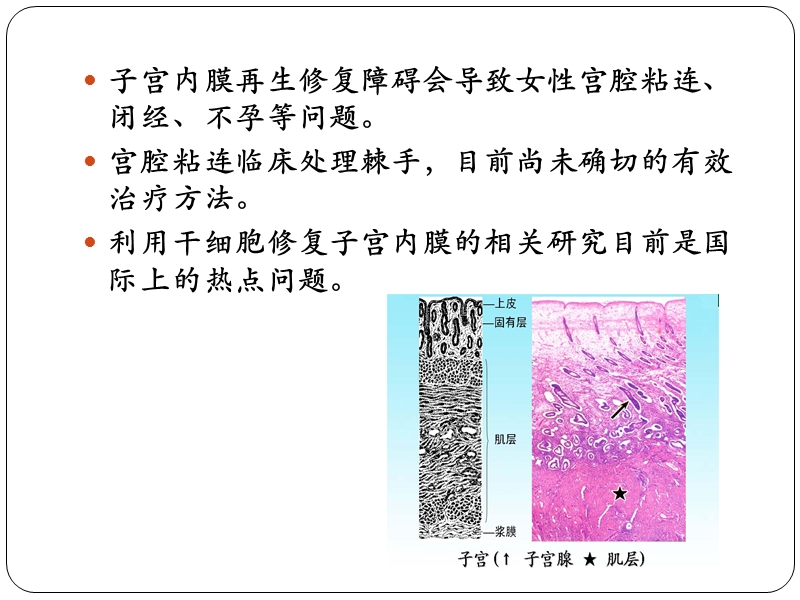 干细胞在子宫内膜损伤修复中的应用 PPT.pptx_第2页