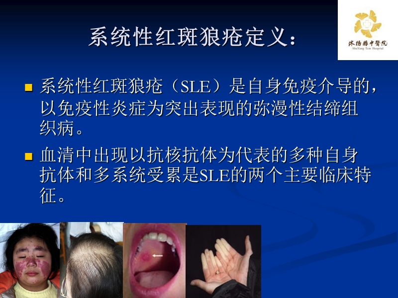 狼疮性肾炎演示文稿.ppt_第2页