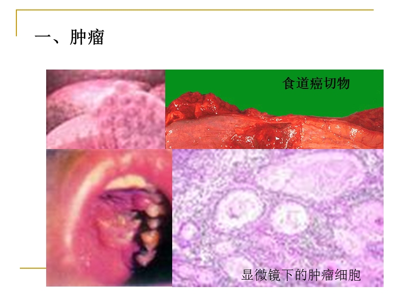 第四节_非传染性疾病.ppt_第2页