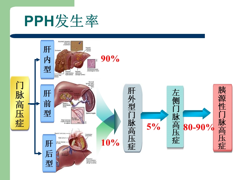 胰源性门脉高压症.ppt_第3页