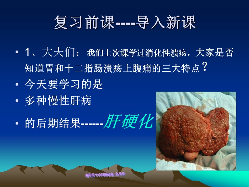 肝硬化完整.ppt_第2页