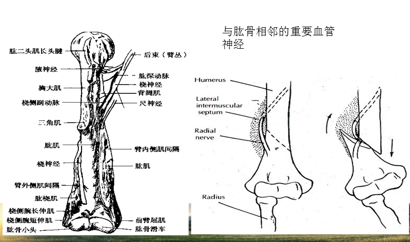 肱骨干骨折.ppt_第3页