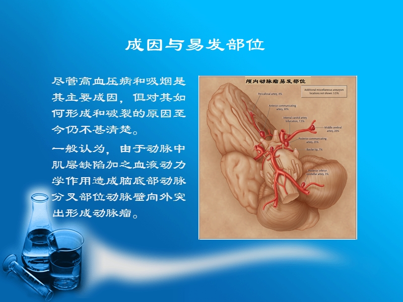 珠网膜下腔出血与动脉瘤.ppt_第3页