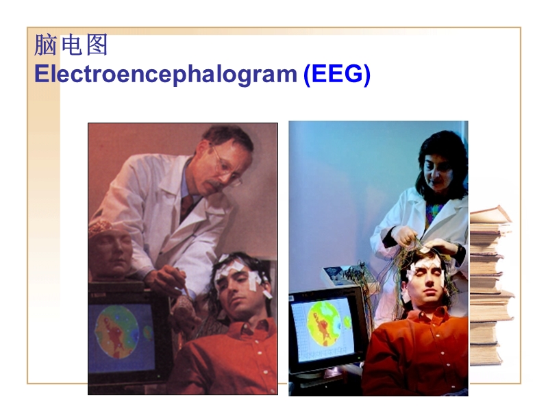 神经系统脑电睡眠.ppt_第3页