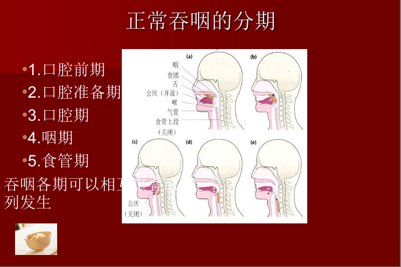 神经性吞咽障碍.ppt_第3页