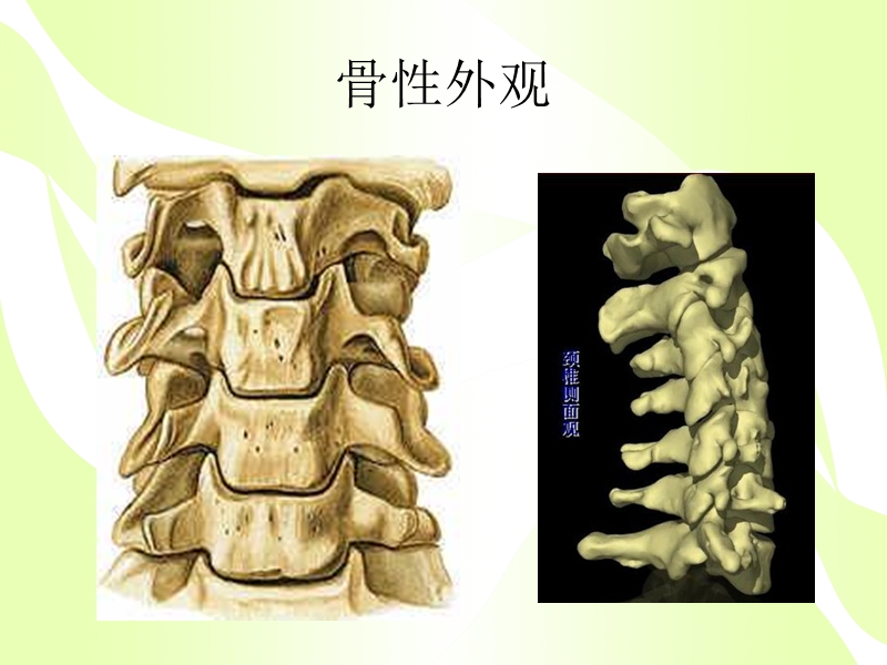 颈椎病健康教育---10.31.ppt_第3页