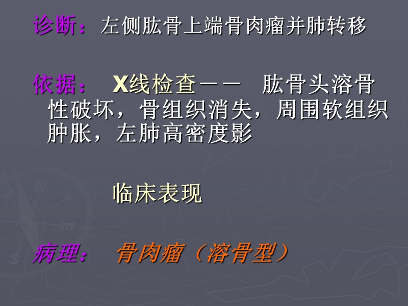 骨肉瘤x线诊断.ppt_第2页