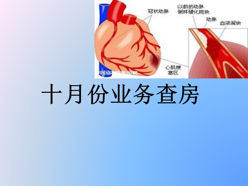 扩张性心肌病.ppt_第1页