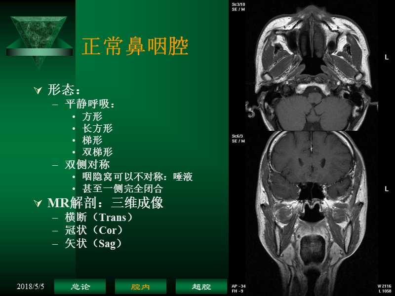 鼻咽癌解剖——鼻咽腔.ppt_第3页