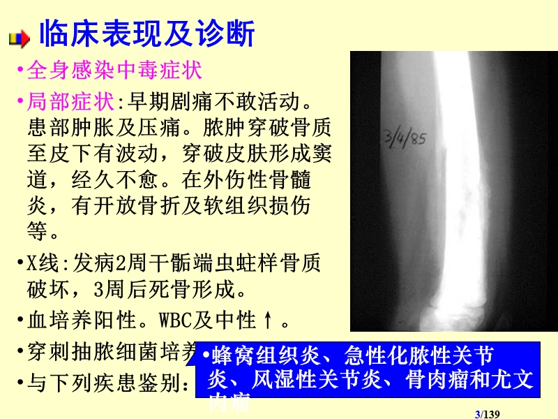 急性血源性骨髓炎.ppt_第3页