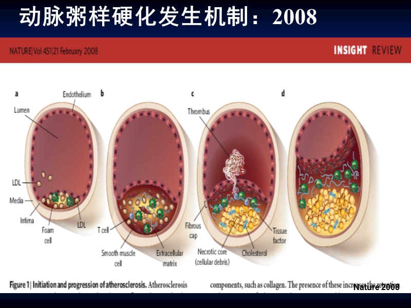 降胆固醇治疗的新思路.ppt_第3页