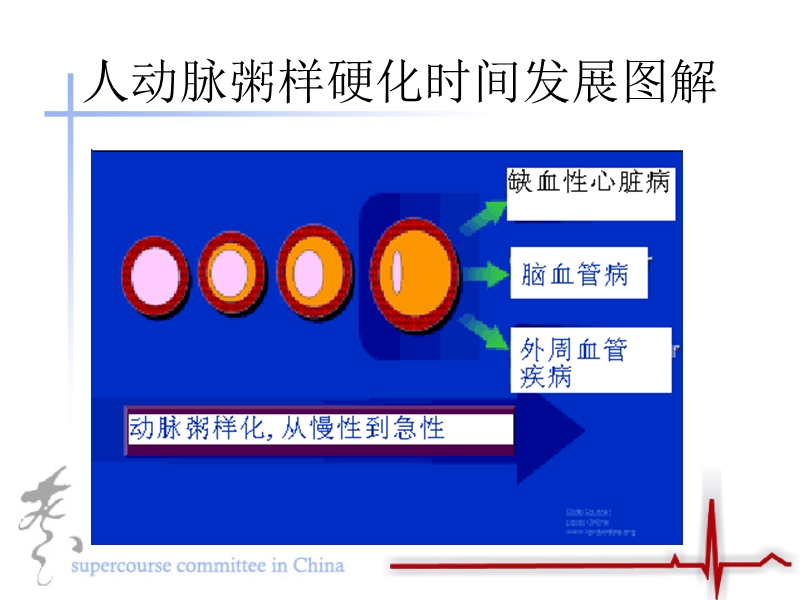 急性冠脉病症的病理机制.ppt_第2页