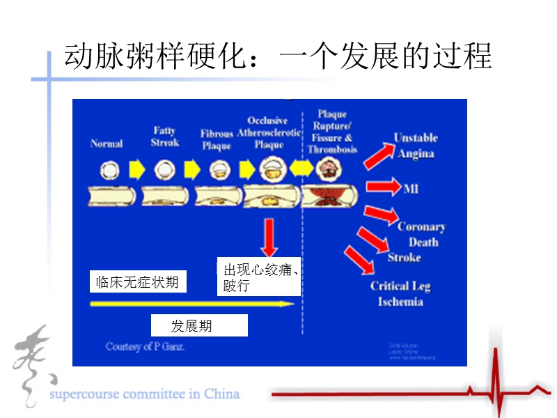 急性冠脉病症的病理机制.ppt_第3页