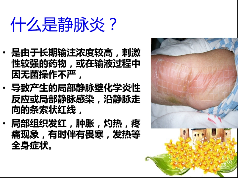 静脉炎的预防和治疗.ppt_第3页