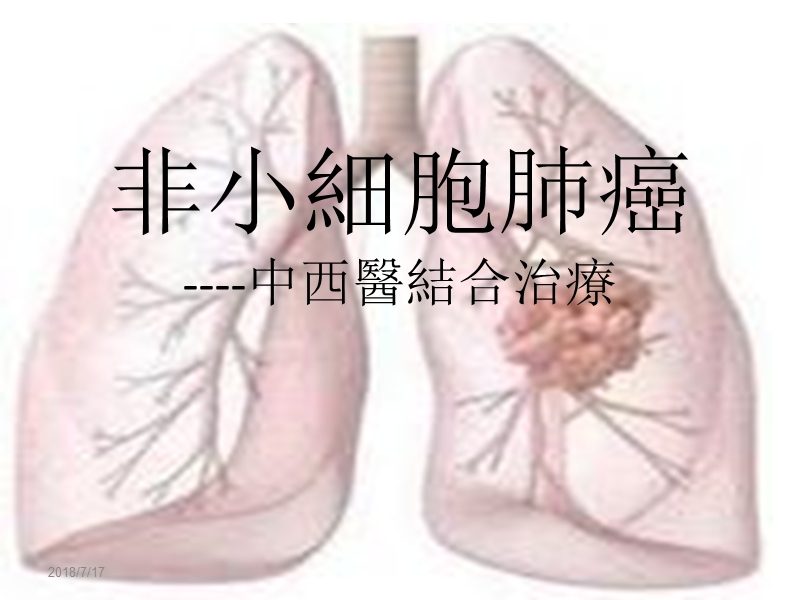 非小细胞肺癌.ppt_第1页