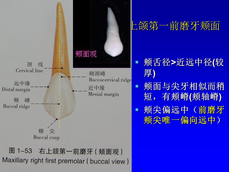 恒牙_前磨牙组.ppt_第3页