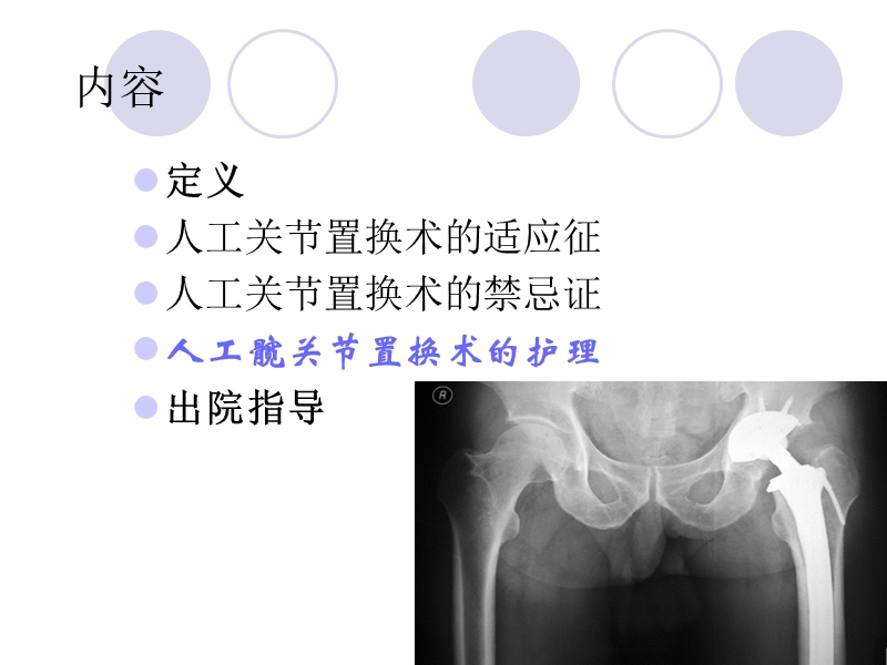 髋关节置换术护理.ppt_第2页