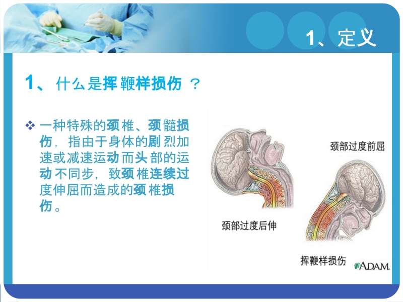 颈椎挥鞭样损伤.pptx_第3页